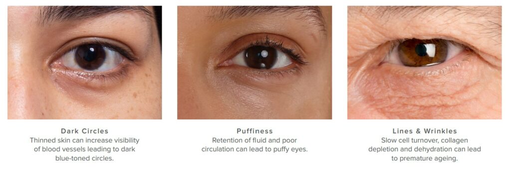 eye treatments at RITUAL Beauty Salons in Hampshire