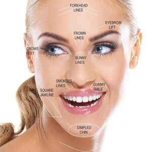 Botox in Alton and Alresford
