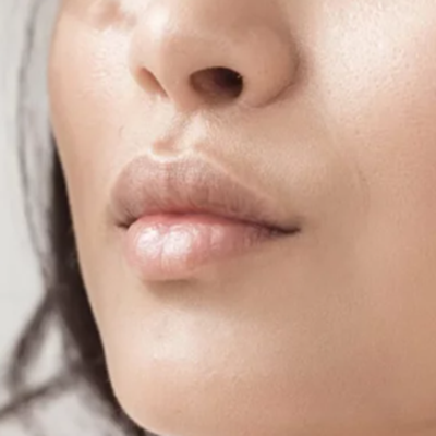 All About Skin Flooding