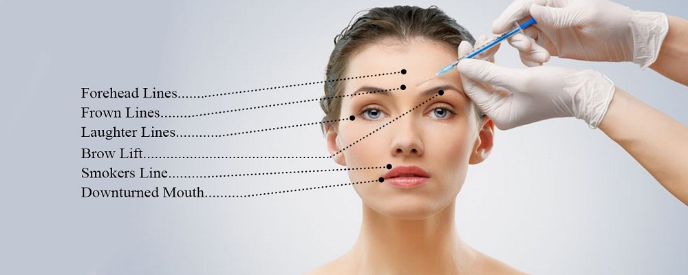 botox at ritual skin clinic hampshire
