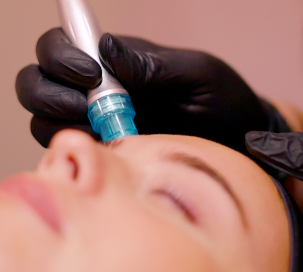 Clearer Skin Starts Here