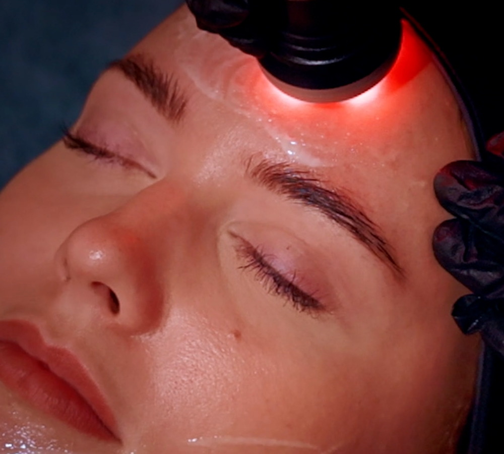Radiofrequency facials Alresford