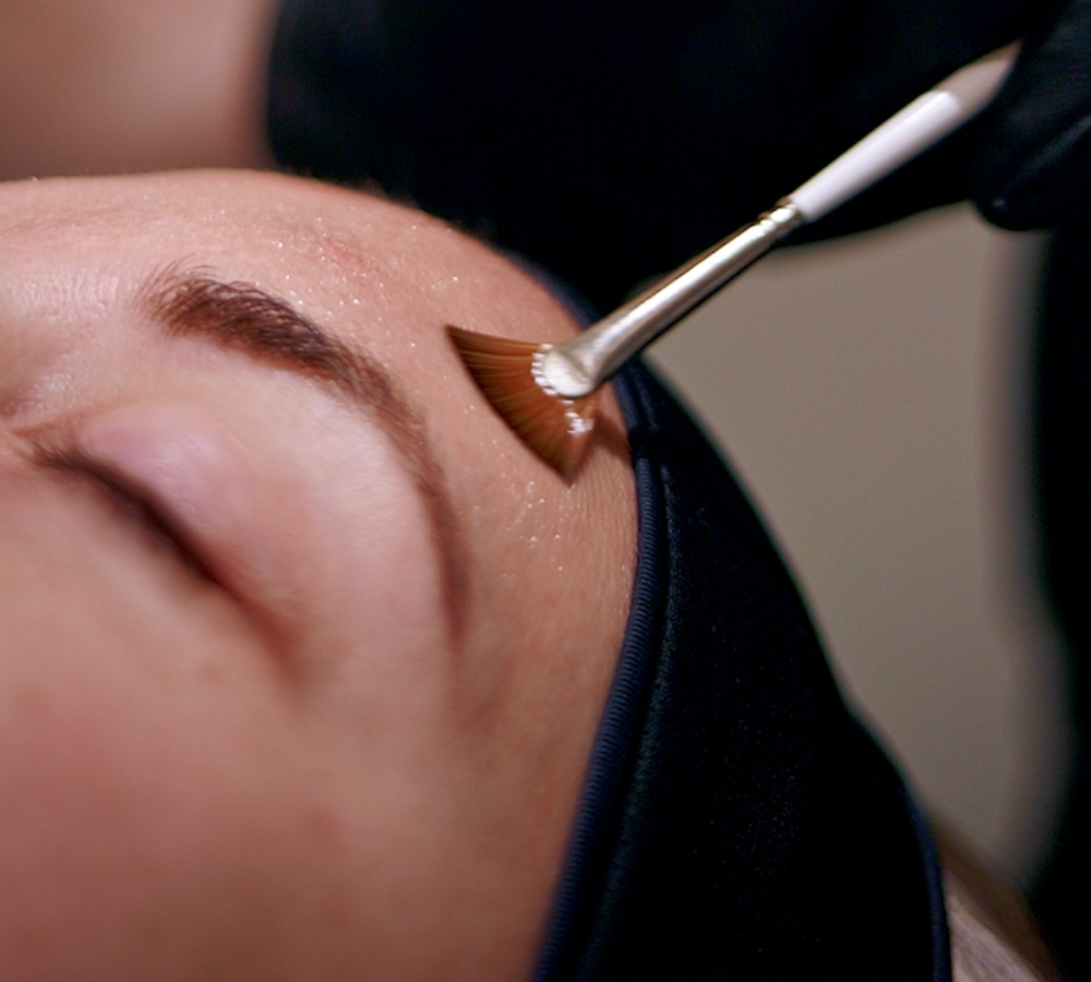Alumier Skin Peels in Alton and Alresford, Hampshre Alumier Skin Peels in Hampshire