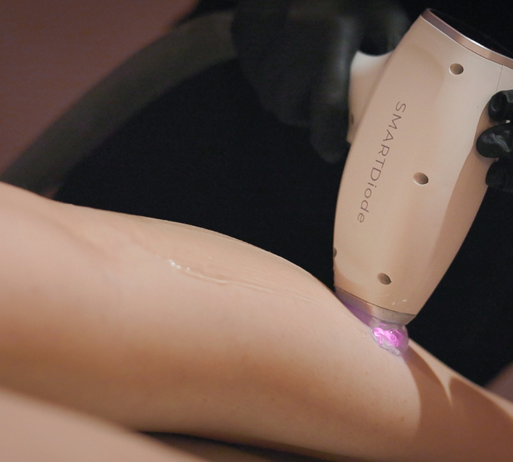 Electrolysis at RITUAL Beauty Salons in Alton and Alresford Electrolysis at RITUAL Beauty Salons in Alton and Alresford