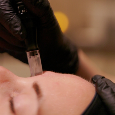 Exosomes in Skincare Exosomes in Skincare