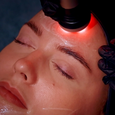 Radio frequency Facials Alresford