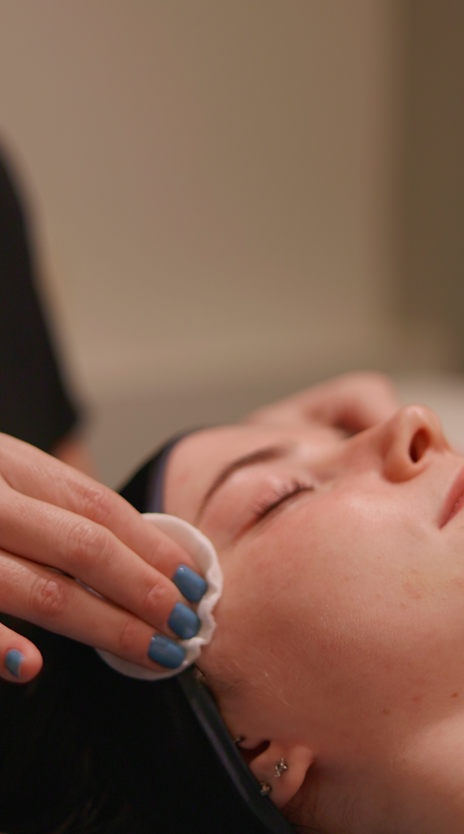 Myth Busting Chemical Peels Myth Busting Chemical Peels